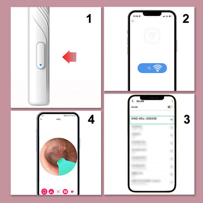 🎉2025 HOT SALE ~50% OFF🎉Earwax Removal Device with HD Camera